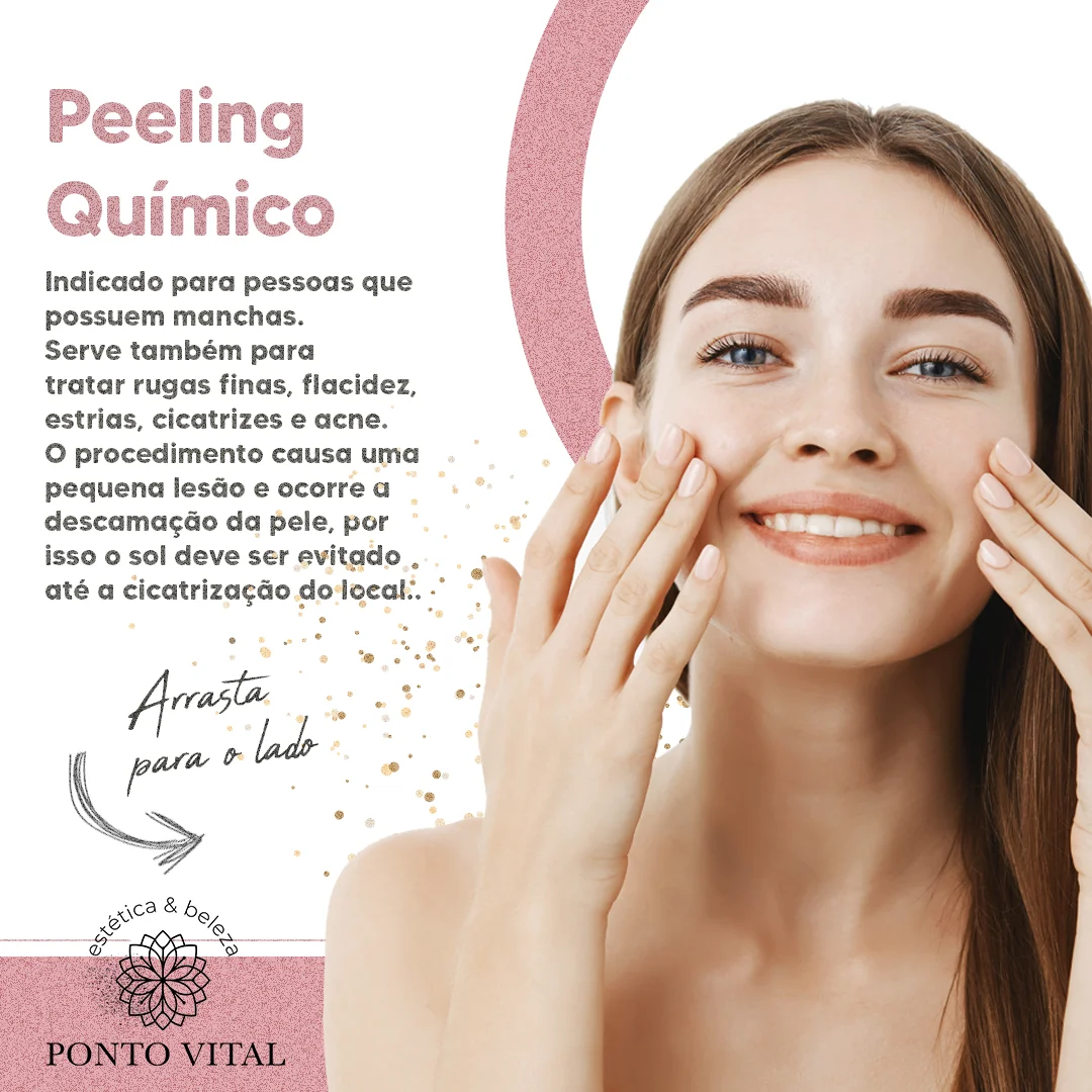 02 - Peeling químico - Clínica Estética Ponto Vital - Clínica Ponto Vital - Estética avançada - Estética Campo Largo