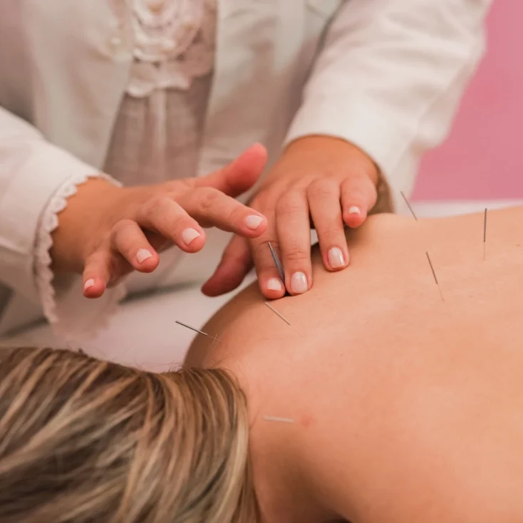 Acupuntura Estética Ponto Vital Campo Largo